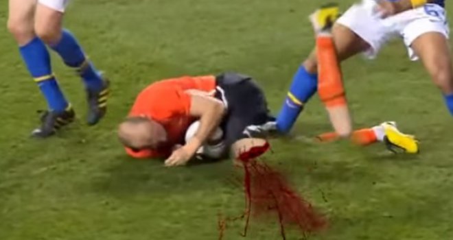 Ovako brutalnu i krvavu fudbalsku utakmicu zasigurno nikad u životu niste vidjeli