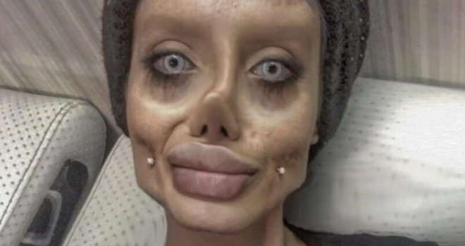Sjećate li se deformisane dvojnice Angeline Jolie? Evo kako je izgledala prije silnih transformacija - nećete vjerovati!
