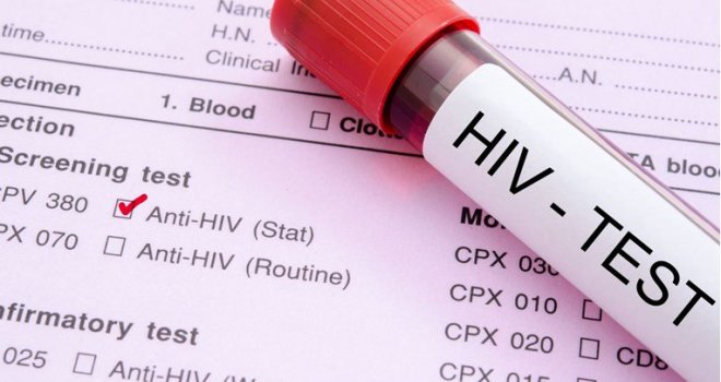 U Nizozemskoj otkrivena nova, visokozarazna varijanta HIV-a