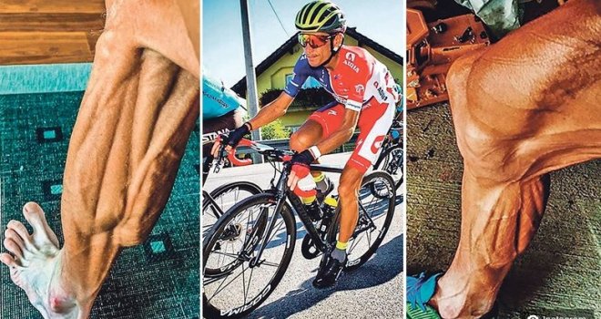 'Moje noge nakon utrke izgledaju ovako': Evo šta stoji iza fotografije koja je šokirala internet, a šta kažu ljekari