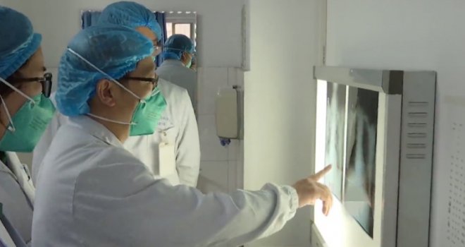 Kina potvrdila 56 smrtnih slučajeva od koronavirusa, 324 osobe u kritičnom stanju