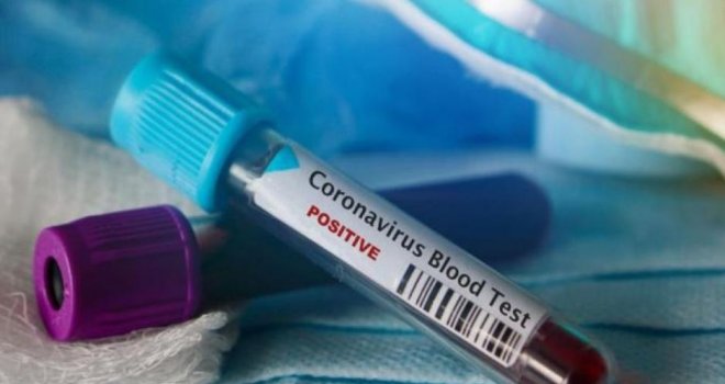 U Sarajevu devet osoba pod nadzorom zbog koronavirusa
