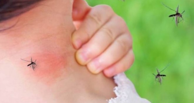 Oprezno ako za praznike putujete ka Jadranu, pojavila se atipična vrsta komaraca: Ostavljaju bolne plikove
