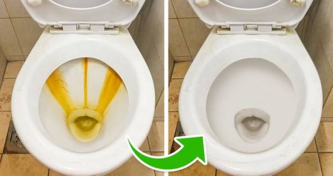 Ovo sigurno niste isprobali: Genijalan recept za čišćenje WC šolje - nikad nije bila blistavija!
