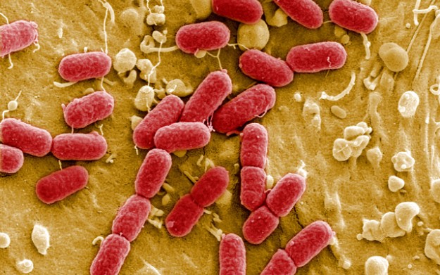 ecoli-ehec-bakterija