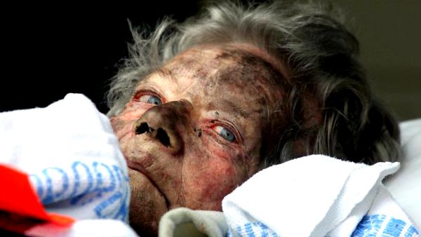 Jedna od povrijeđenih stanarki doma na putu za bolnicu; foto: The Daily Telegraph