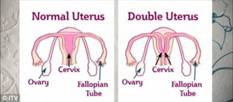 dvije vagine