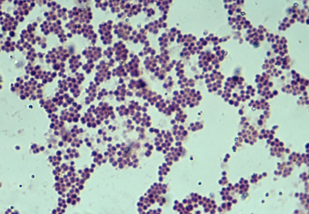 meningitis