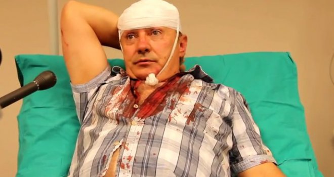 Pušten na slobodu napadač na Slavu Kukića!