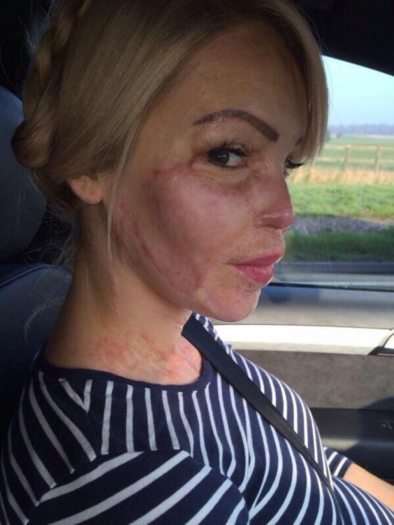 katie-piper-2