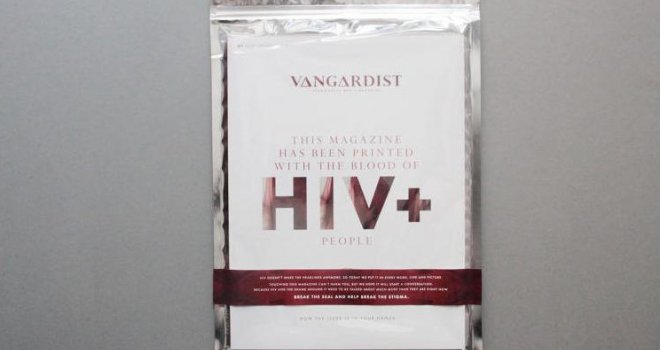 Moguće i krivične posljedice: Kolika kazna čeka dobrovoljnog davaoca krvi od koga je pacijentkinja dobila virus HIV?