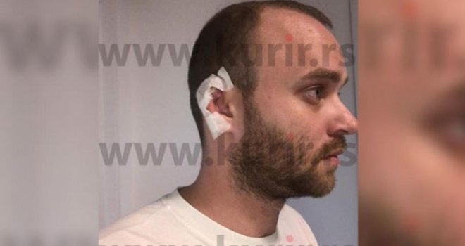 Drama u Budvi: Brutalno napadnut poznati pjevač Danijel Alibabić, otkinuto mu uho...