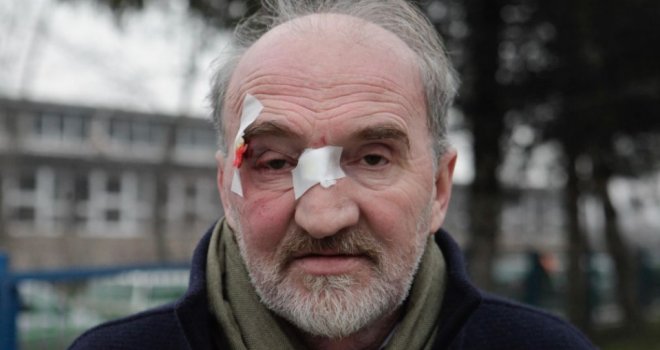 Objavljene fotografije napadača, Nedžad Latić tvrdi: Htjeli su da me ubiju! Ispuštao je krvožedne krike...