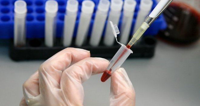 Naučnici razvili test krvi koji predviđa šanse za smrt i tačan je nevjerovatnih 83 posto