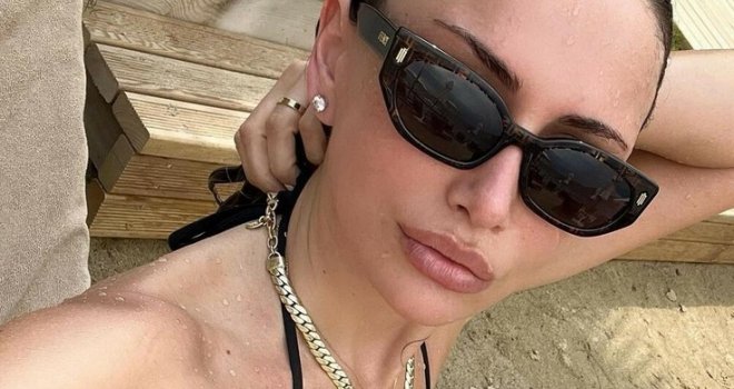 Emina Jahović prije i poslije: Potrošila 15.000 € da bi bila kao Barbika, a samo nos je  operisala 5 puta
