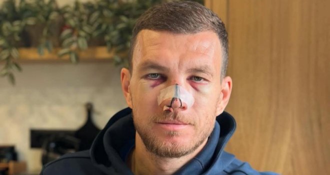 Džeko objavio kako izgleda pred Kipar, hoće li zaigrati?